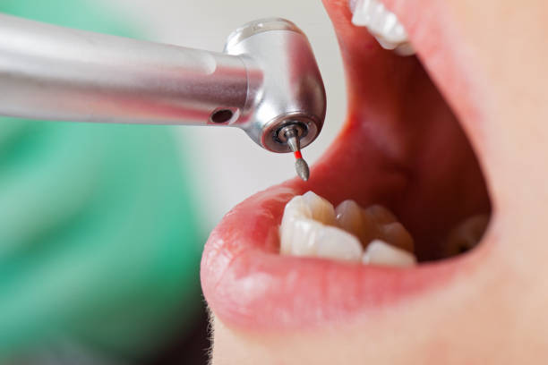 Best Pediatric Emergency Dentist in Rolling Hills Estates, CA